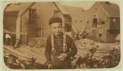 Richard Mills, 8 years old, showing a severely cut finger. Is a…, Maine, 1911