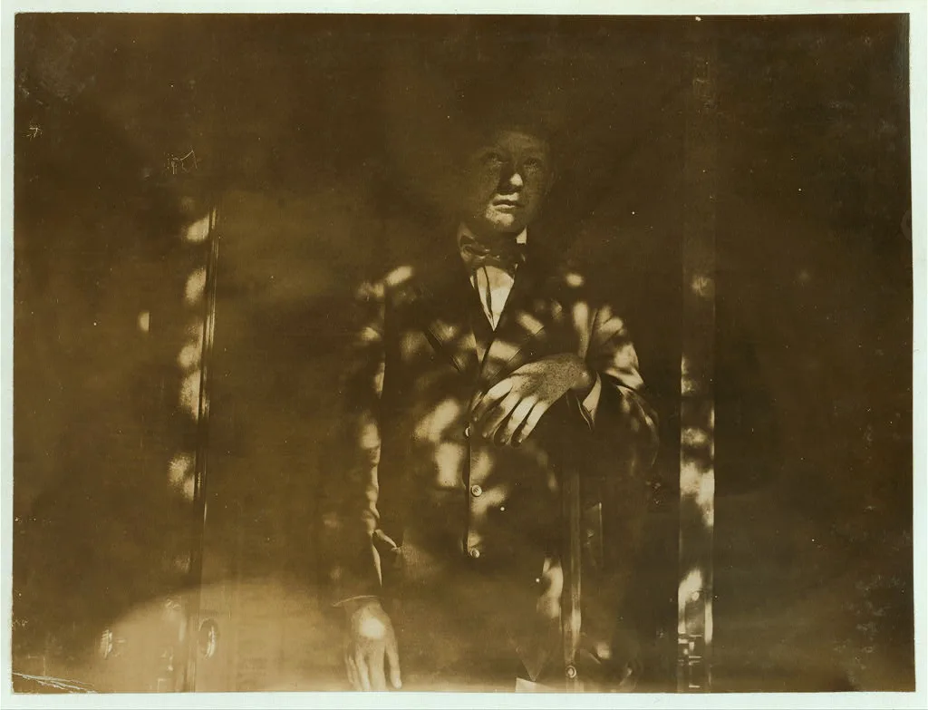 One-legged Boy from Pennsylvania Coal Mine. See 954. L.W.H. Location:…, 1909