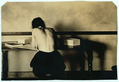 [Fannie Bowman, 15 years old. Postural deformity. Correct position in…, Massachusetts, 1917