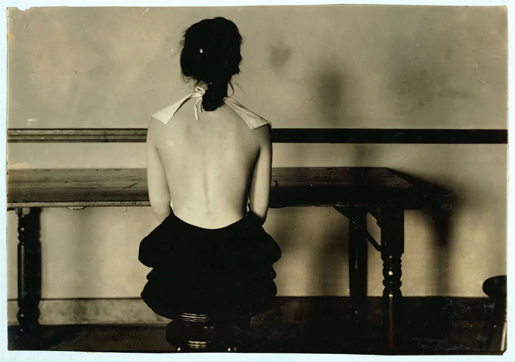 Correct posture for 4663. Need for advice of examining physician. See…, Massachusetts, 1917