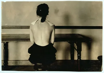 Correct posture for 4663. Need for advice of examining physician. See…, Massachusetts, 1917